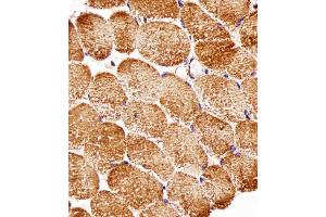 Immunohistochemical analysis of paraffin-embedded H. (Raptor Antikörper  (AA 1005-1329))