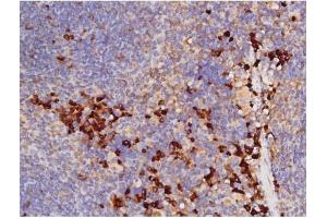 ABIN6267358 at 1/200 staining Mouse spleen tissue sections by IHC-P.