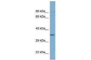 WB Suggested Anti-UBXN1  Antibody Titration: 0. (UBXN1 Antikörper  (Middle Region))