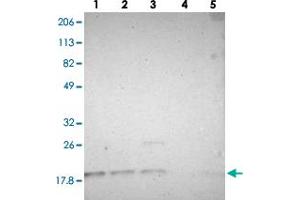 Western blot analysis of lane 1: RT-4, lane 2: U-251 MG, lane 3: A-431, lane 4: Liver and lane 5: Tonsil using SUB1 polyclonal antibody . (SUB1 Antikörper)