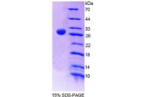 SDS-PAGE analysis of Rat FMO2 Protein. (FMO2 Protein)