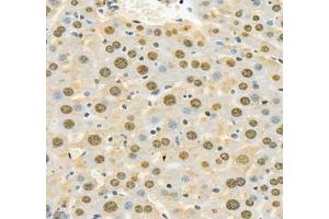 Immunohistochemistry (Paraffin-embedded Sections) (IHC (p)) image for anti-Adenosine Kinase (ADK) antibody (ABIN7072953)