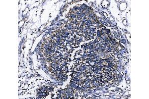 IHC analysis of TOMM70 using anti-TOMM70 antibody (ABIN7599855).