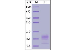 SDS-PAGE (SDS) image for CD52 (CD52) (AA 25-36) (Active) protein (His tag,AVI tag,Biotin) (ABIN6951030)