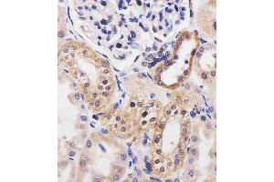 (ABIN6242147 and ABIN6577254) staining ADK in human kidney tissue sections by Immunohistochemistry (IHC-P - paraformaldehyde-fixed, paraffin-embedded sections). (ADK Antikörper  (AA 1-345))