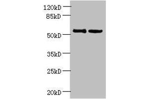 Western blot All lanes: UTP15 antibody at 5 μg/mL Lane 1: Hela whole cell lysate Lane 2: HepG2 whole cell lysate Secondary Goat polyclonal to rabbit IgG at 1/10000 dilution Predicted band size: 59, 37, 57 kDa Observed band size: 59 kDa (UTP15 Antikörper  (AA 234-518))