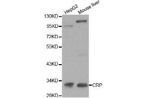 CRP Antikörper  (AA 1-224)