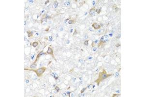 Immunohistochemistry of paraffin-embedded rat brain using IL22 antibody (ABIN5975407) at dilution of 1/100 (40x lens). (IL-22 Antikörper)