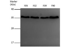 WB Image Sample (30 ug of whole cell lysate) A: A431 , 12% SDS PAGE VDAC1 antibody antibody diluted at 1:1000 (VDAC1 Antikörper)