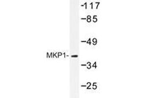 Western blot analysis of MKP1 antibody in extracts from Jurkat cells.
