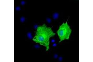 Anti-AK5 mouse monoclonal antibody (ABIN2452726) immunofluorescent staining of COS7 cells transiently transfected by pCMV6-ENTRY AK5 (RC222241). (Adenylate Kinase 5 Antikörper)