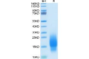 Human GIP on Tris-Bis PAGE under reduced condition. (GIP Protein (AA 22-93) (His tag))