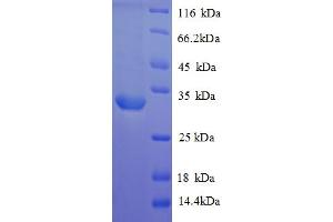SDS-PAGE (SDS) image for Arginine Vasopressin Receptor 1A (AVPR1A) (AA 7-52), (partial) protein (GST tag) (ABIN5712990)
