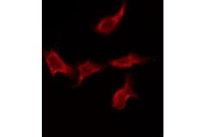 ABIN6275577 staining Hela by IF/ICC. (SCN4A Antikörper  (Internal Region))