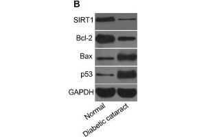 Expression of miR-211 and mRNA and protein expressions of SIRT1, Bcl-2, Bax, and p53 in lens tissues of mice(A) miR-211 expression and mRNA and protein expressions of SIRT1, Bcl-2, Bax, and p53 in mice lens, (B) strip chart of SIRT1, Bcl-2, Bax, and p53 proteins, (C) expressions of SIRT1, Bcl-2, Bax, and p53 proteins in mice lens, *, P<0. (p53 Antikörper  (AA 1-393))