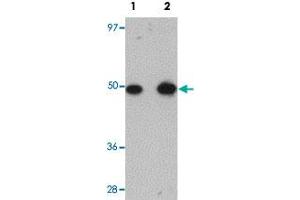 Western blot analysis of rat lung tissue with TMEM184B polyclonal antibody  at (Lane 1) 1 and (Lane 2) 2 ug/mL dilution. (TMEM184B Antikörper  (C-Term))