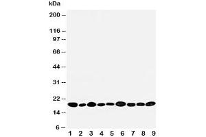 Western blot testing of NME2 antibody and rat samples 1: heart;  2: brain;  3: liver;  4: skeletal muscle;   and human samples 5: PANC;  6: HeLa;  7: SMMC-7721;  8: U87;  9: COLO320 cell lysate.