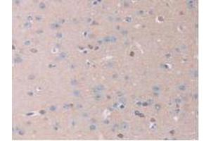 IHC-P analysis of Mouse Brain Tissue, with DAB staining. (IL13RA2 Antikörper  (AA 228-338))