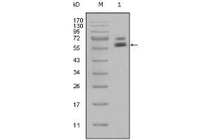 Western blot analysis using CK5 mouse mAb against Hela cell lysate (1).