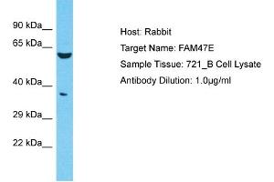 Host: Rabbit Target Name: FAM47E Sample Type: 721_B Whole Cell lysates Antibody Dilution: 1. (FAM47E Antikörper  (C-Term))