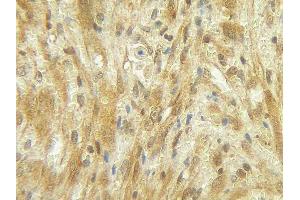 Immunohistochemistry (IHC) image for anti-Colony Stimulating Factor 3 (Granulocyte) (CSF3) antibody (Biotin) (ABIN2473720) (G-CSF Antikörper  (Biotin))