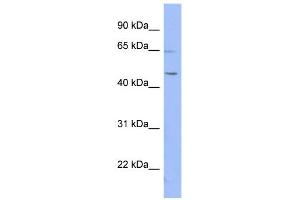 WB Suggested Anti-RNF12 Antibody Titration:  0. (RLIM Antikörper  (N-Term))
