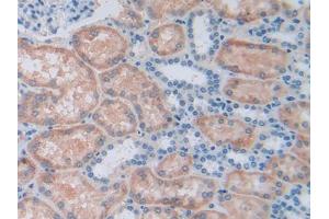 DAB staining on IHC-P; Samples: Human Kidney Tissue (ALDH7A1 Antikörper  (AA 1-539))