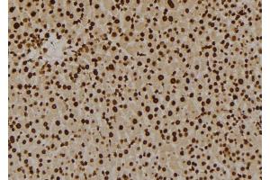 ABIN6276023 at 1/100 staining Mouse liver tissue by IHC-P.