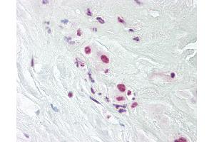 Anti-DPPA4 antibody IHC of human placenta. (DPPA4 Antikörper  (AA 1-50))