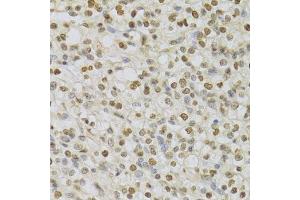 Immunohistochemistry (Paraffin-embedded Sections) (IHC (p)) image for anti-Hepatoma-Derived Growth Factor (HDGF) (AA 1-240) antibody (ABIN6141694)