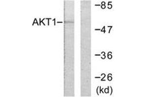Western blot analysis of extracts from HeLa cells, treated with Etoposide 25uM 24h, using Akt (Ab-246) Antibody. (AKT1 Antikörper  (AA 212-261))