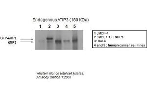 Western Blotting (WB) image for anti-Microtubule Associated Tumor Suppressor 1 (MTUS1) (Middle Region) antibody (ABIN2781855)