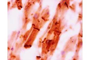 Immunohistochemistry on paraffin section of human heart