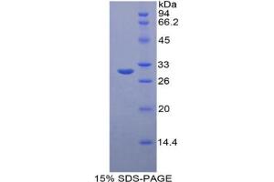 SDS-PAGE analysis of Mouse OCT Protein. (OTC Protein)