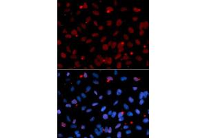 Immunofluorescence analysis of U2OS cell using SFRS1 antibody. (SRSF1 Antikörper  (pSer1))