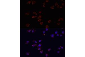 Immunofluorescence analysis of HeLa cells using  antibody (ABIN3021237, ABIN3021238, ABIN3021239 and ABIN6214079) at dilution of 1:100. (ARF6 Antikörper  (AA 1-175))