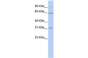 SLC27A2 antibody used at 1 ug/ml to detect target protein.