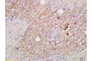 Formalin-fixed and paraffin embedded mouse lymphoma labeled with Rabbit Anti BCMA/CD269 Polyclonal Antibody, Unconjugated (ABIN705041) at 1:200 followed by conjugation to the secondary antibody and DAB staining (BCMA Antikörper  (AA 12-110))