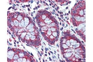 PGLS antibody was used for immunohistochemistry at a concentration of 4-8 ug/ml. (PGLS Antikörper  (Middle Region))
