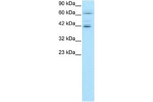 WB Suggested Anti-ETV6 Antibody Titration:  0. (ETV6 Antikörper  (C-Term))
