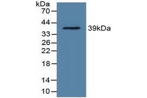 Detection of Recombinant LDHC, Rat using Polyclonal Antibody to Lactate Dehydrogenase C (LDHC) (Lactate Dehydrogenase C Antikörper  (AA 1-332))