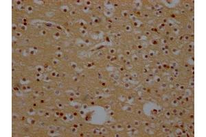 IHC image of ABIN7127436 diluted at 1:100 and staining in paraffin-embedded human brain tissue performed on a Leica BondTM system. (Rekombinanter XPO1 Antikörper)