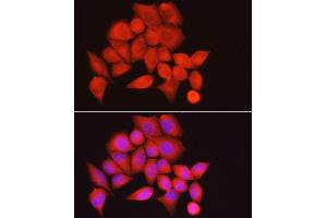 Immunofluorescence analysis of HeLa cells using PPP1R12A Rabbit pAb (ABIN6128260, ABIN6146059, ABIN6146061 and ABIN6213896) at dilution of 1:100 (40x lens). (PPP1R12A Antikörper  (AA 1-200))