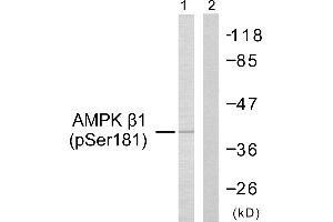 Western blot analysis of extracts from Jurkat cells, using AMPK β1 (Phospho-Ser181) Antibody (#A0410). (PRKAB1 Antikörper  (pSer181))
