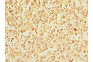 Immunohistochemistry (IHC) image for anti-Integrin, alpha E (Antigen CD103, Human Mucosal Lymphocyte Antigen 1, alpha Polypeptide) (ITGAE) (AA 19-200) antibody (ABIN7156455)