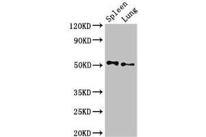 Western Blot Positive WB detected in: Rat spleen tissue, Rat lung tissue All lanes: PSEN2 antibody at 3 μg/mL Secondary Goat polyclonal to rabbit IgG at 1/50000 dilution Predicted band size: 51, 47 kDa Observed band size: 51 kDa (Presenilin 2 Antikörper  (AA 7-77))