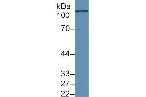 Detection of C5a in Human Serum using Monoclonal Antibody to Complement Component 5a (C5a) (C5A Antikörper  (AA 678-751))