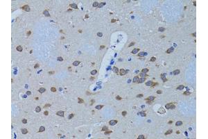 Immunohistochemistry of paraffin-embedded rat brain using PLCB1 antibody. (Phospholipase C beta 1 Antikörper)