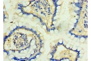 Immunohistochemistry of paraffin-embedded human small intestine tissue using ABIN7163815 at dilution of 1:100