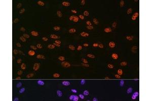 Immunofluorescence analysis of C6 cells using Phospho-Histone H3(S10) Polyclonal Antibody at dilution of 1:100 (40x lens). (Histone 3 Antikörper  (pSer10))